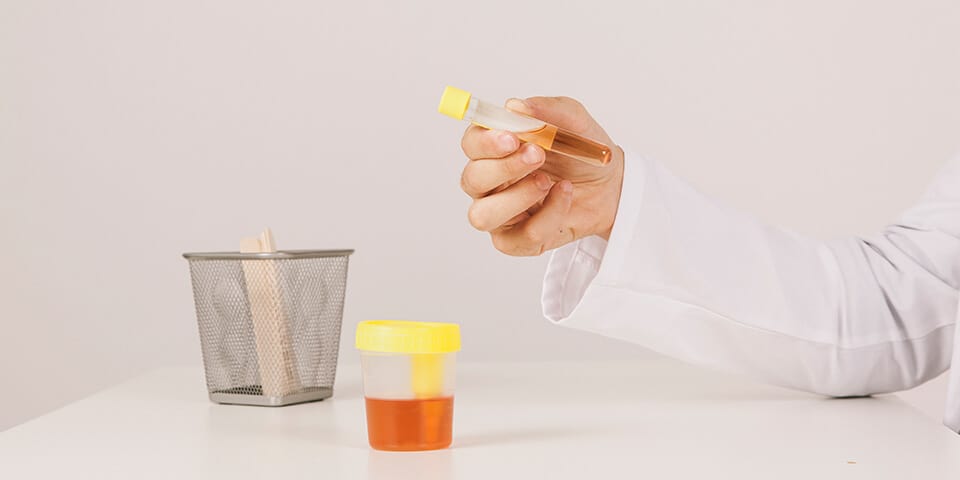 Your Urine is Dark Yellow 